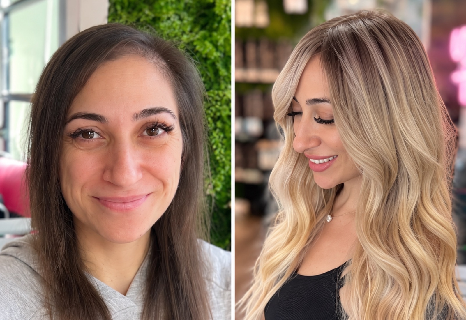 Before and after — a thinning hairline restored to full blonde length, non-surgically